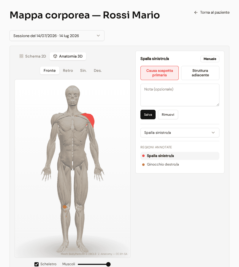 Modello anatomico 3D della mappa corporea in PhysioFlow, con una regione annotata